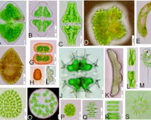 Comunidade fitoplanctônica de ambientes lóticos na zona de amortecimento do PNI. a. Cosmarium denticulatum Borge. b Euastrum sp. c Euastrum ansatum Ehrenberg ex Ralfs. d. Botryococcus braunii Kützing. e. Euglena spirogyra Ehrenberg. f. Peridinium sp. g. Cosmarium portianum Archer. h. Trachelomonas armata (Ehrenb.) F. Stein var. longispina Playfair emend. Deflandre. i. Eunotia camelus Ehrenberg. j. Xanthidium trilobum Nordsted. k. Eunotia zygodon Ehrenberg. l. Tetmemorus brebissonii Ralfs. m. Phacus longicauda (Ehrenberg) Dujardin var. longicauda. n. Pediastrum obtusum Lucks. o. Eudorina elegans Ehrenberg. p. Pandorina morum (Müller) Bory. q. Scenedesmus obliquus (Turpin) Kützing var. dimorphus (Turpin) Hansgirg. r. Spondylosium pulchrum (Bailey) Archer. s. Pediastrum duplex Meyen var. gracillimum West & West. Fotos: Liliane Caroline Servat